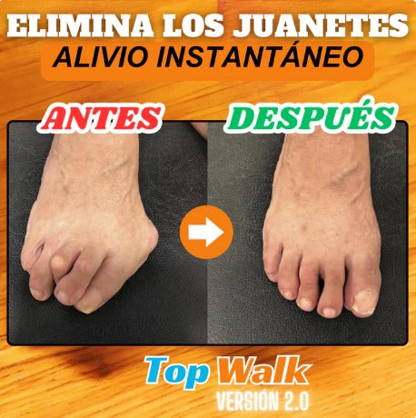 ✨🦶🏼Dispositivo corrector de Juanetes🦶🏼FISIOPRO ADVANCED®️✨